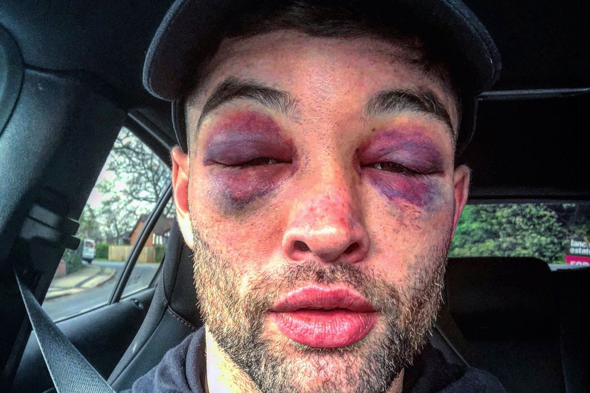 Scott Fitzgerald EXCLUSIVE: I smacked Anthony Fowler about in second gear