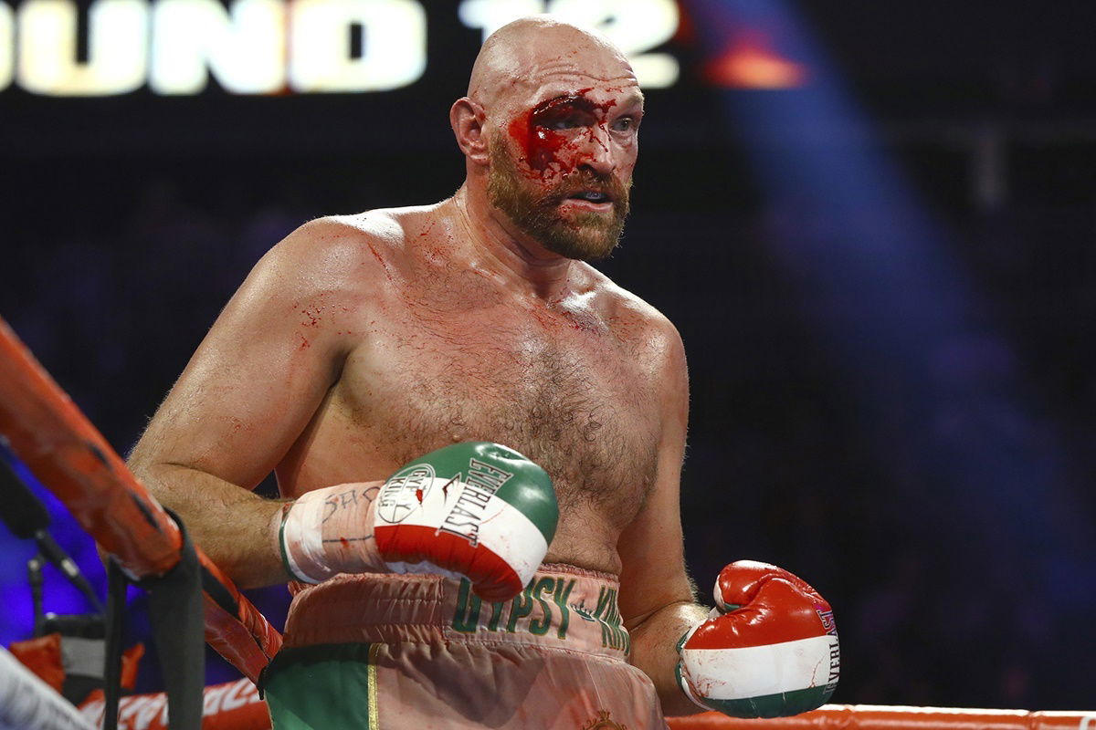 Tyson Fury – ‘One-dimensional Deontay Wilder can be hurt regularly’ – all the conference call quotes