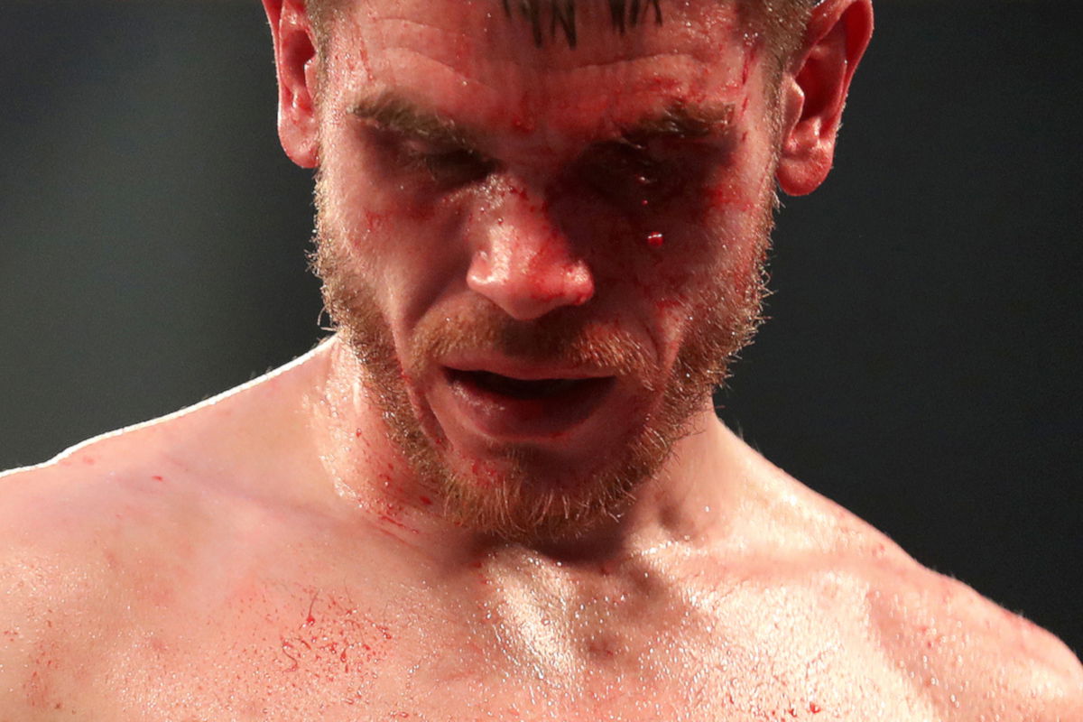 Tommy Ward vs Thomas Essomba (Mark Robinson/Matchroom)